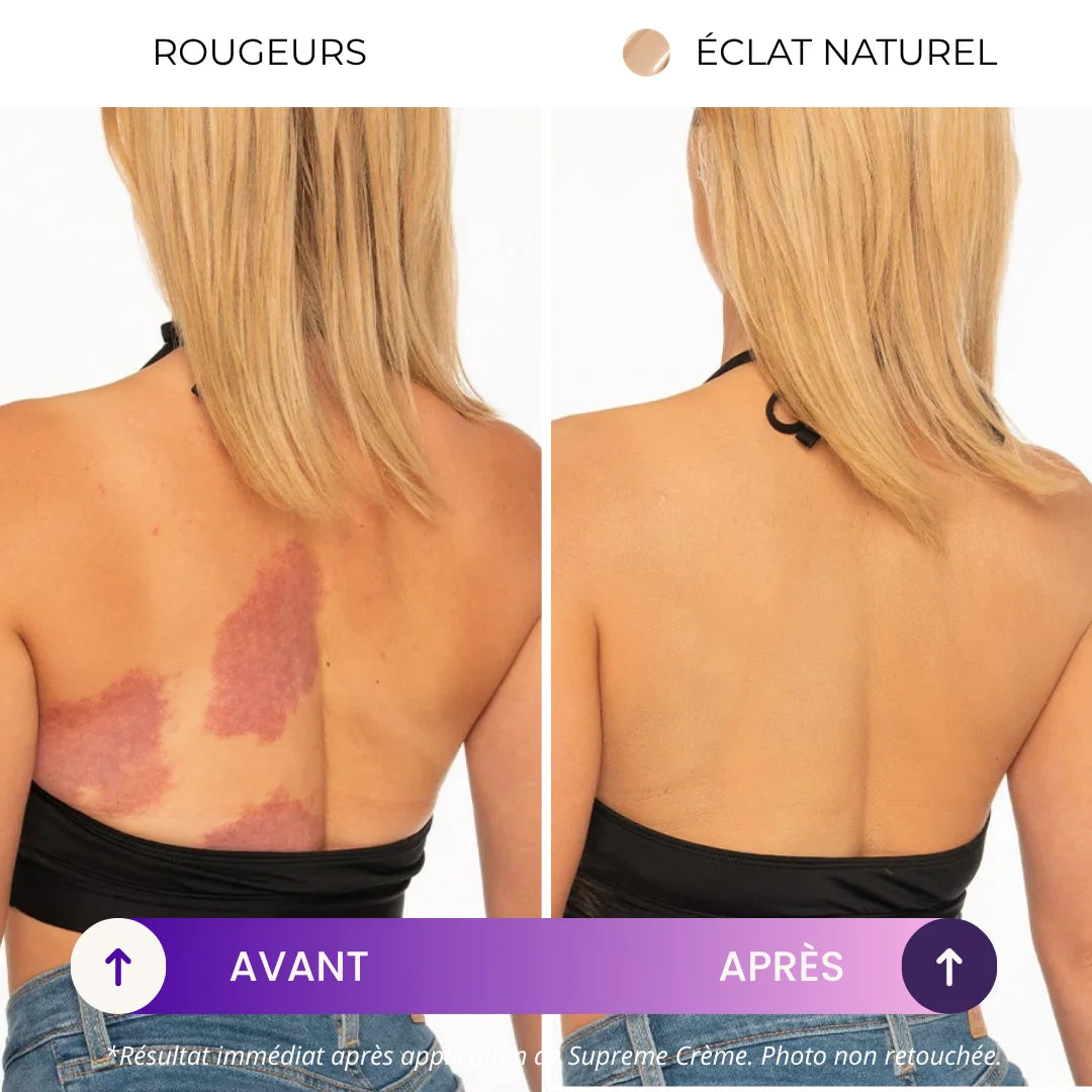 Supreme Crème | Le secret des femmes confiantes