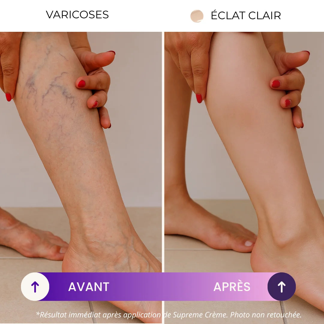 Supreme Crème | Le secret des femmes confiantes