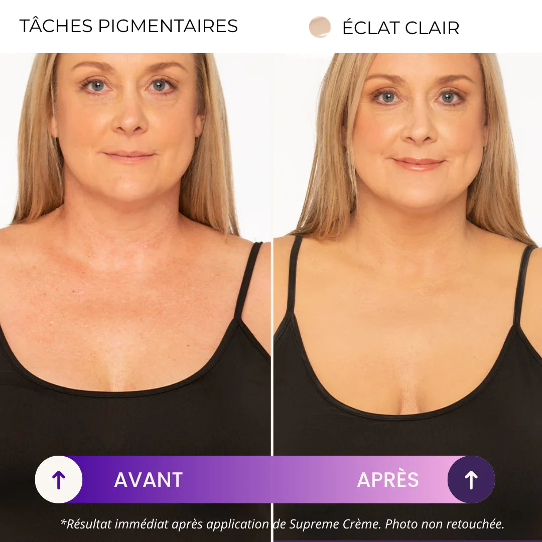 Supreme Crème | Le secret des femmes confiantes